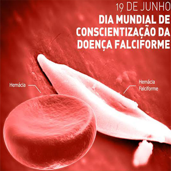 Dia Mundial da Conscientiza��o da Doen�a Falciforme